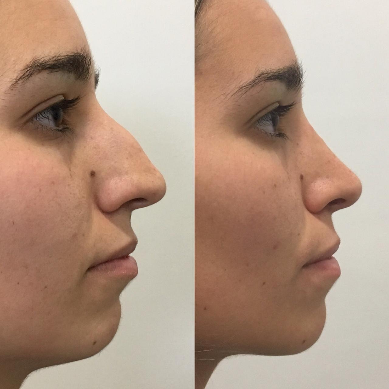 PHOTO-2020-03-11-07-45-32_2