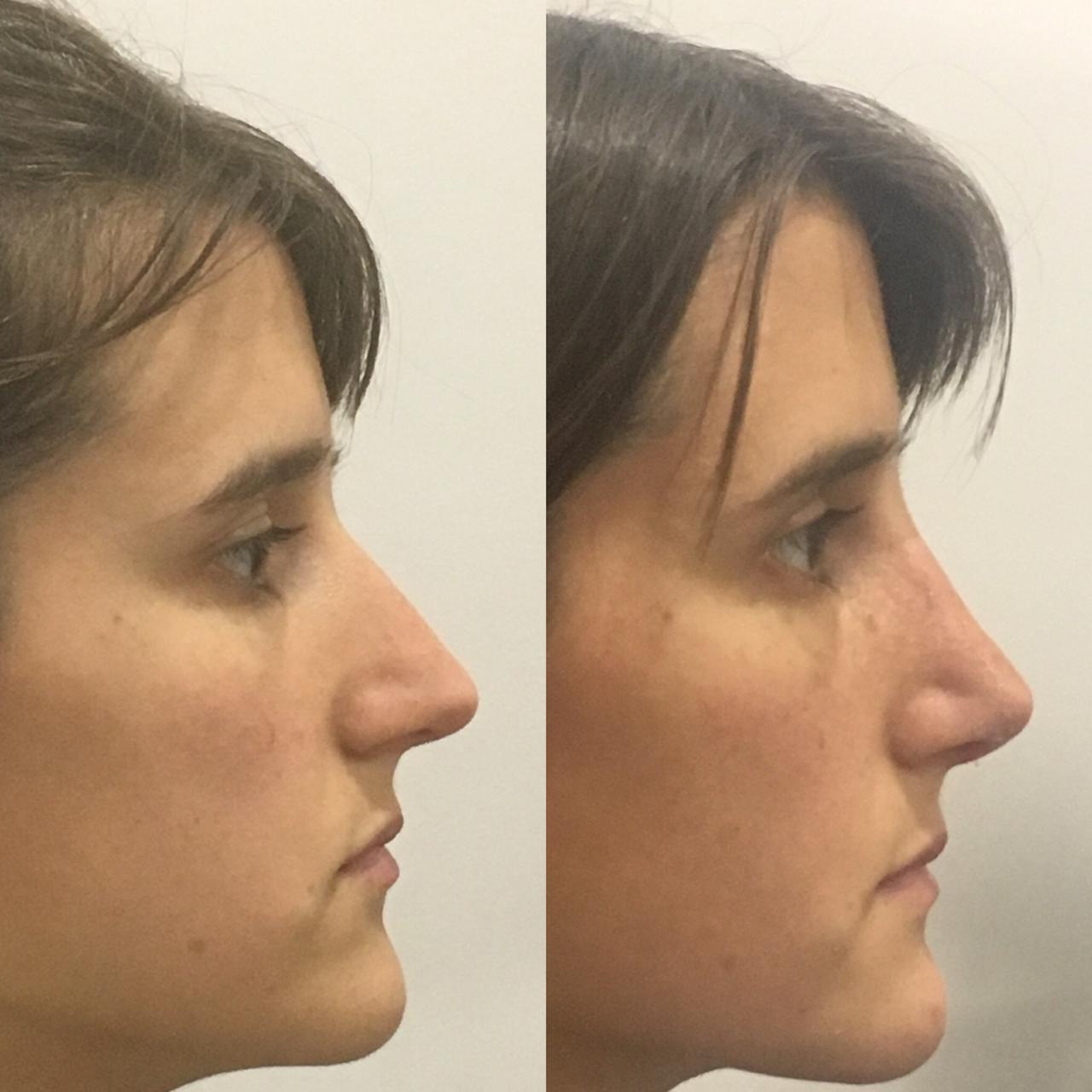 PHOTO-2020-03-11-07-45-45_1